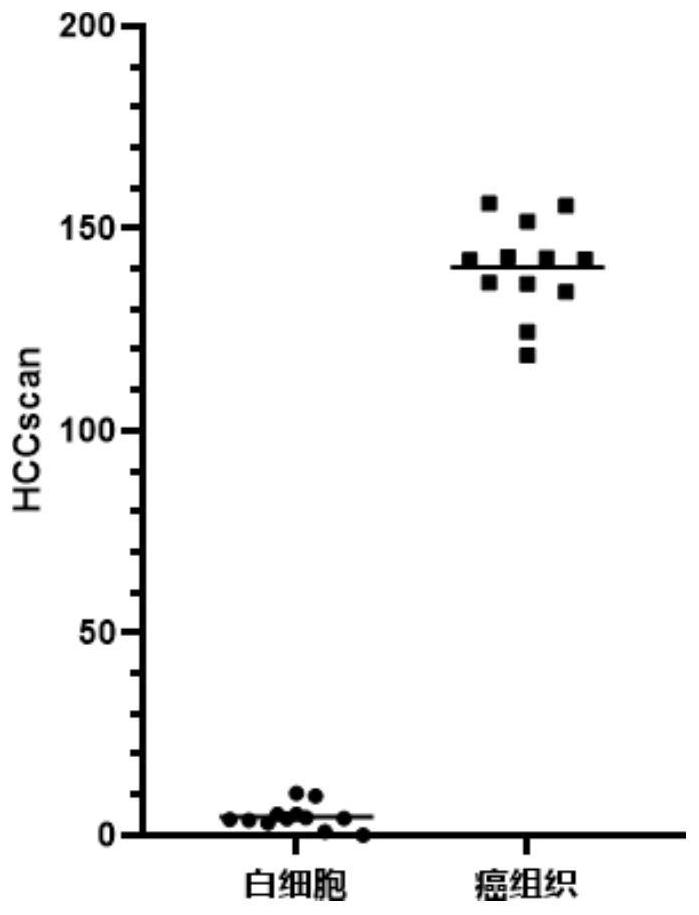 Combined marker for early diagnosis of liver cancer and its application