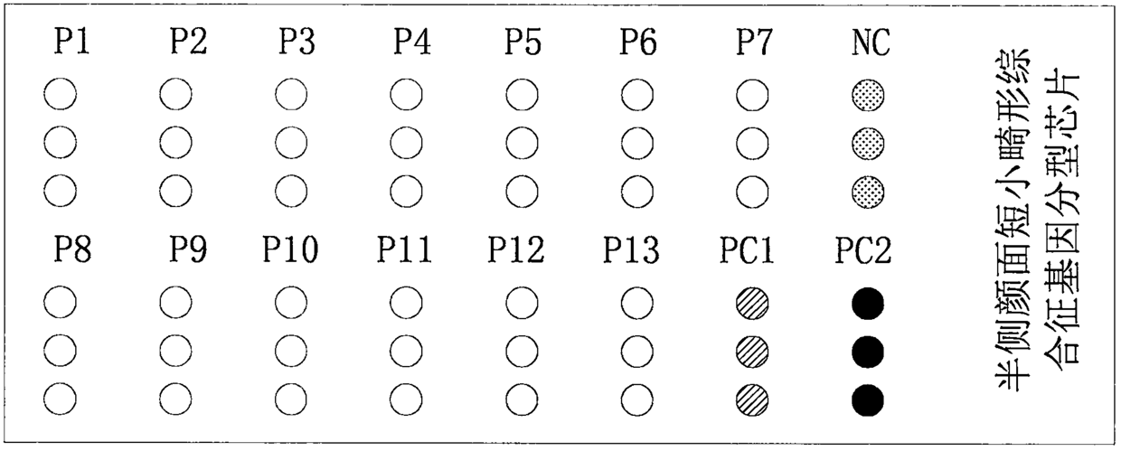 Gene chip for non-invasive prenatal assessment of hemifacial microsomia, kit and application method of gene chip