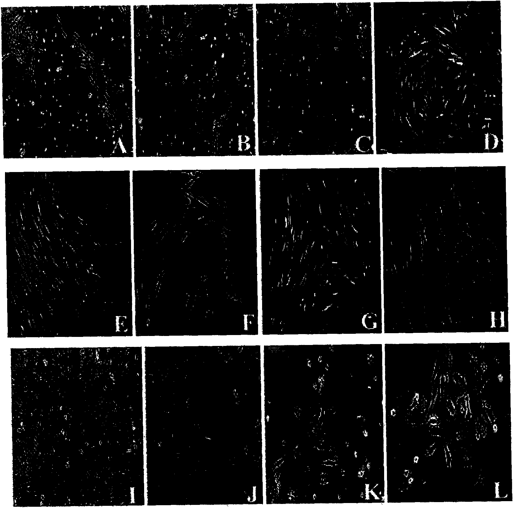 Method for preparing human umbilical cord mesenchymal stem cells