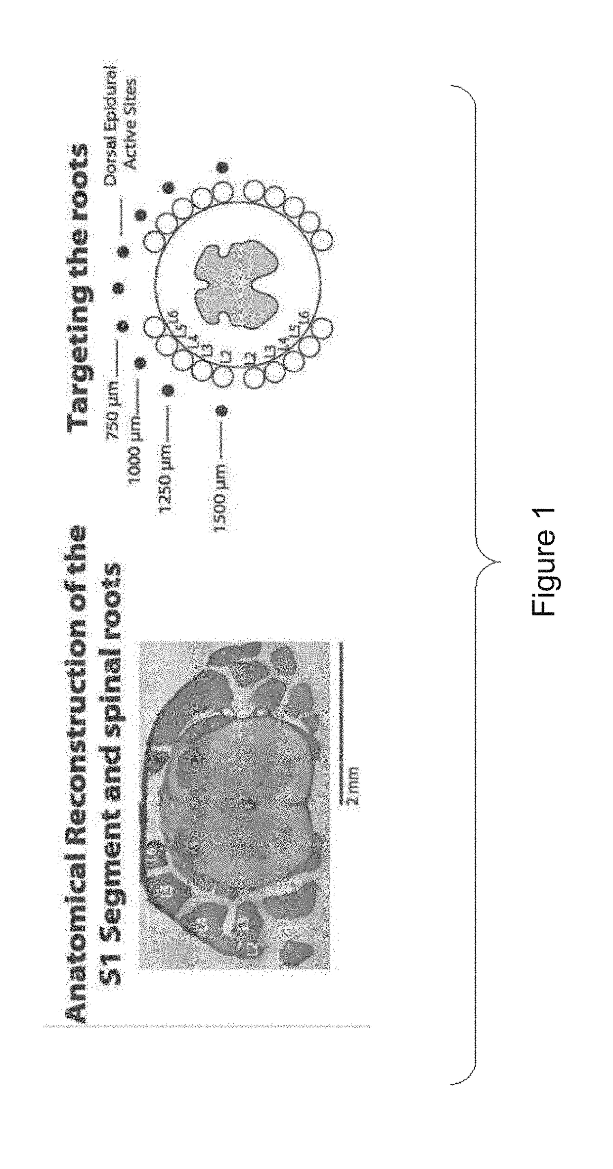 System for selective spatiotemporal stimulation of the spinal cord