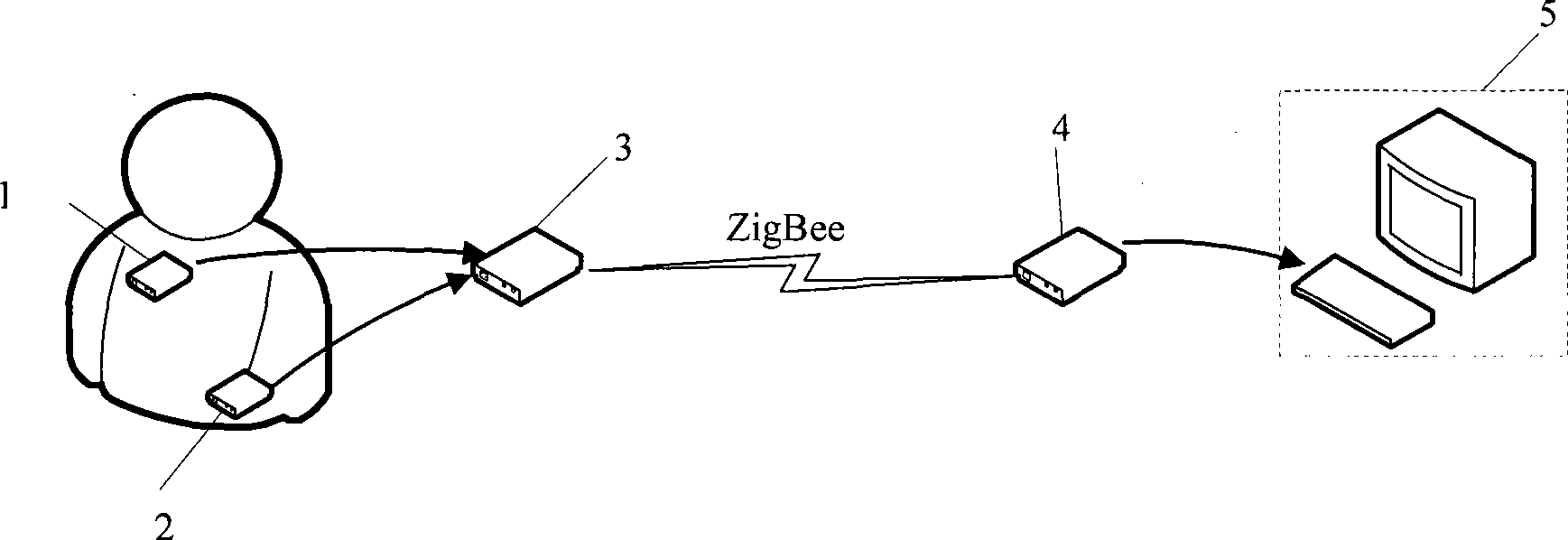 Wireless cardiac bioelectricity monitoring system with motion artifact elimination function