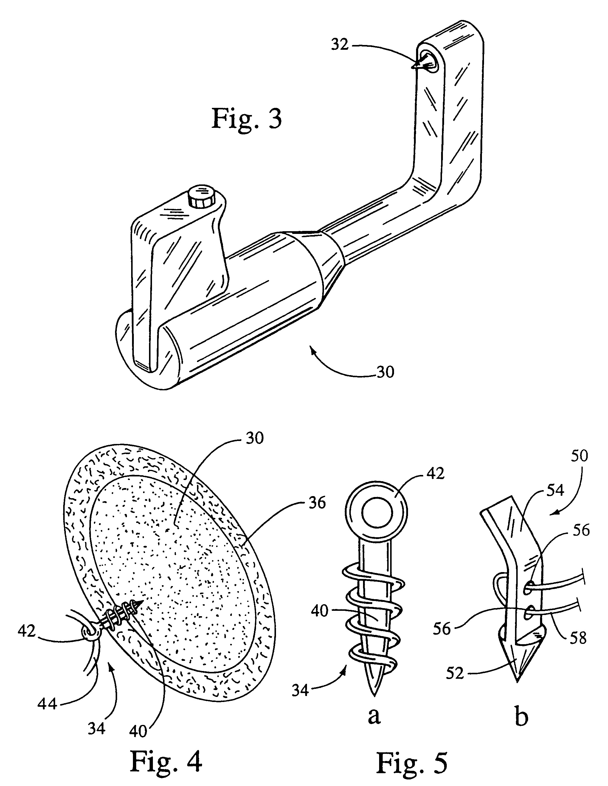 System for securing sutures, grafts and soft tissue to bone and periosteum