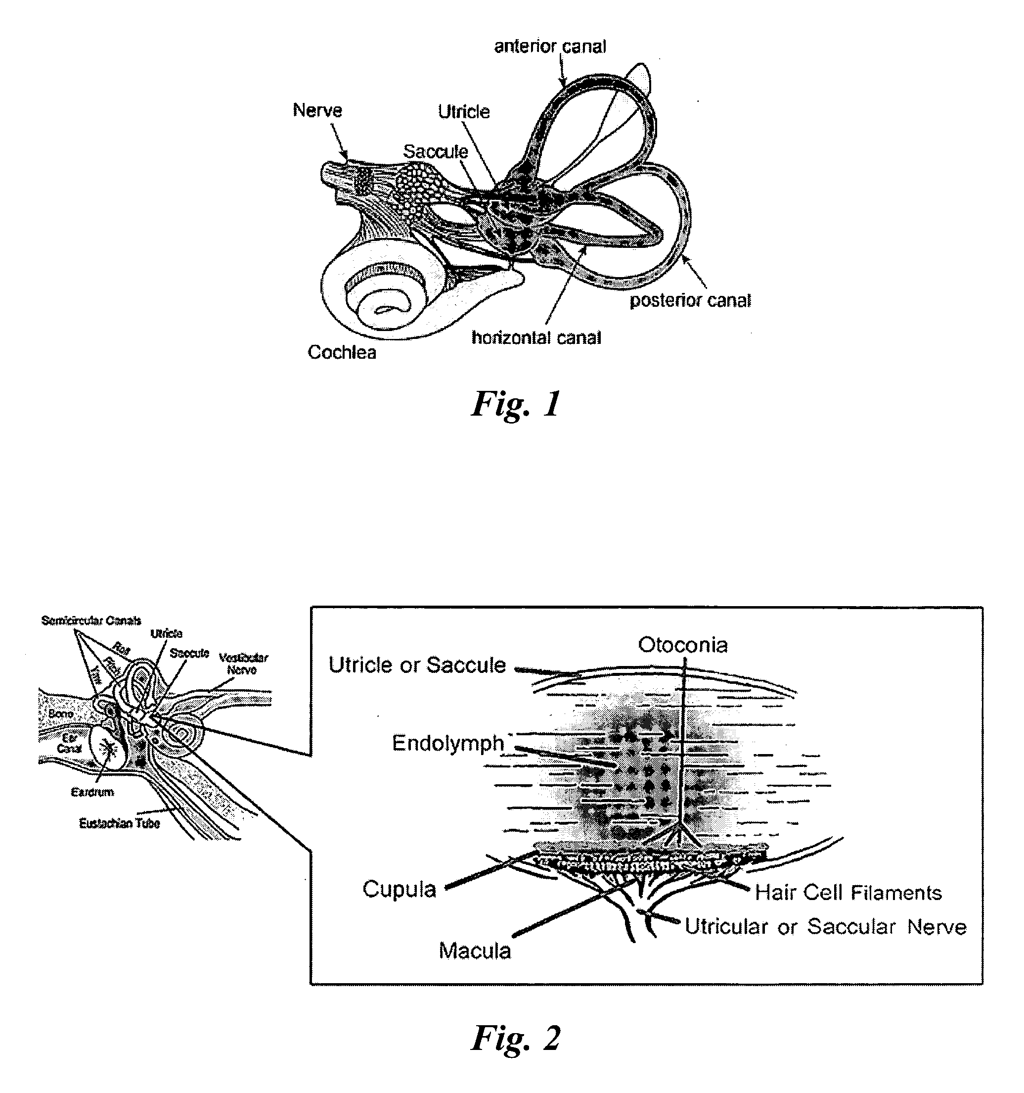 Electromagnetic personnel interdiction control method and system