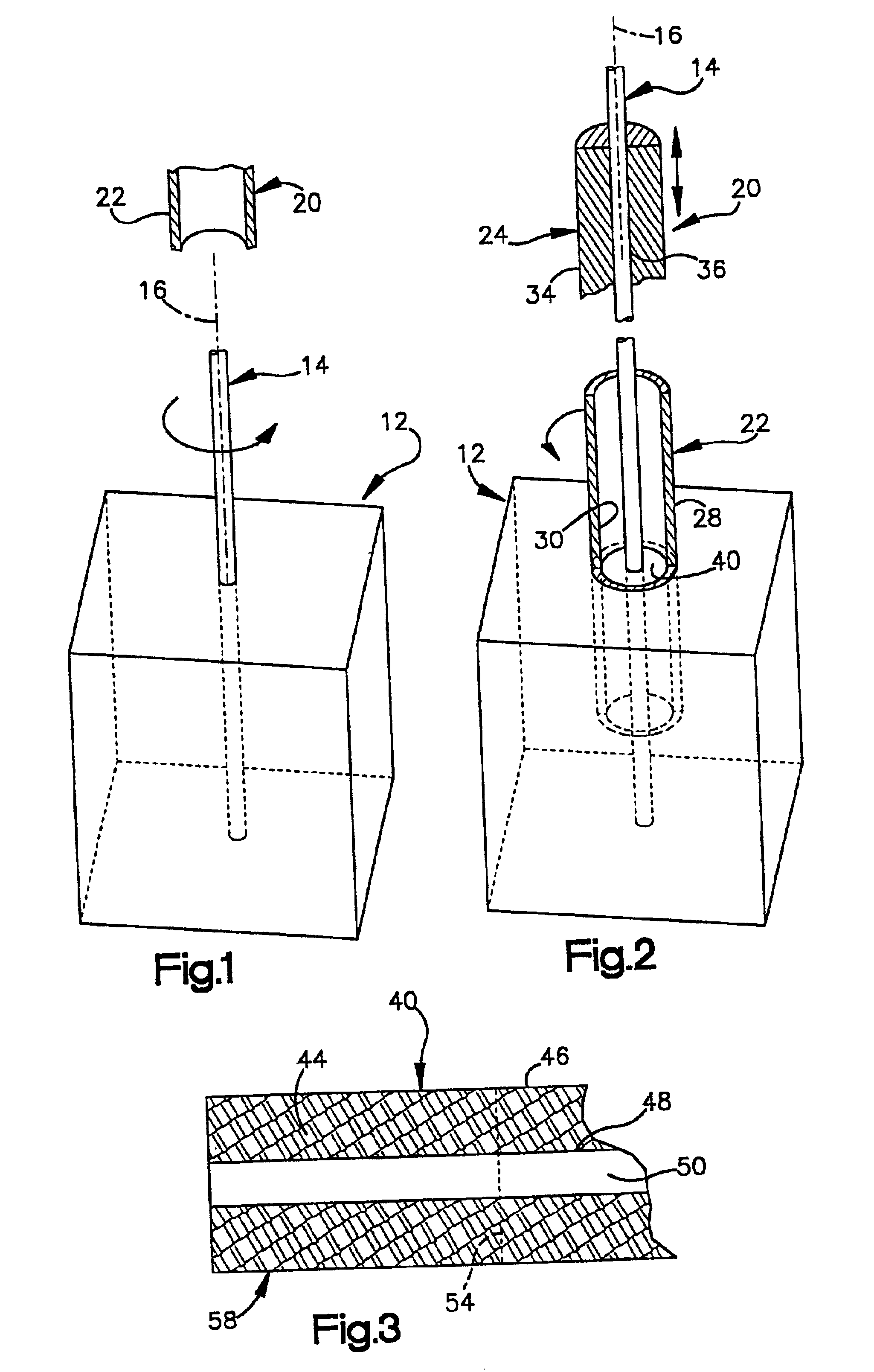 Suture anchor