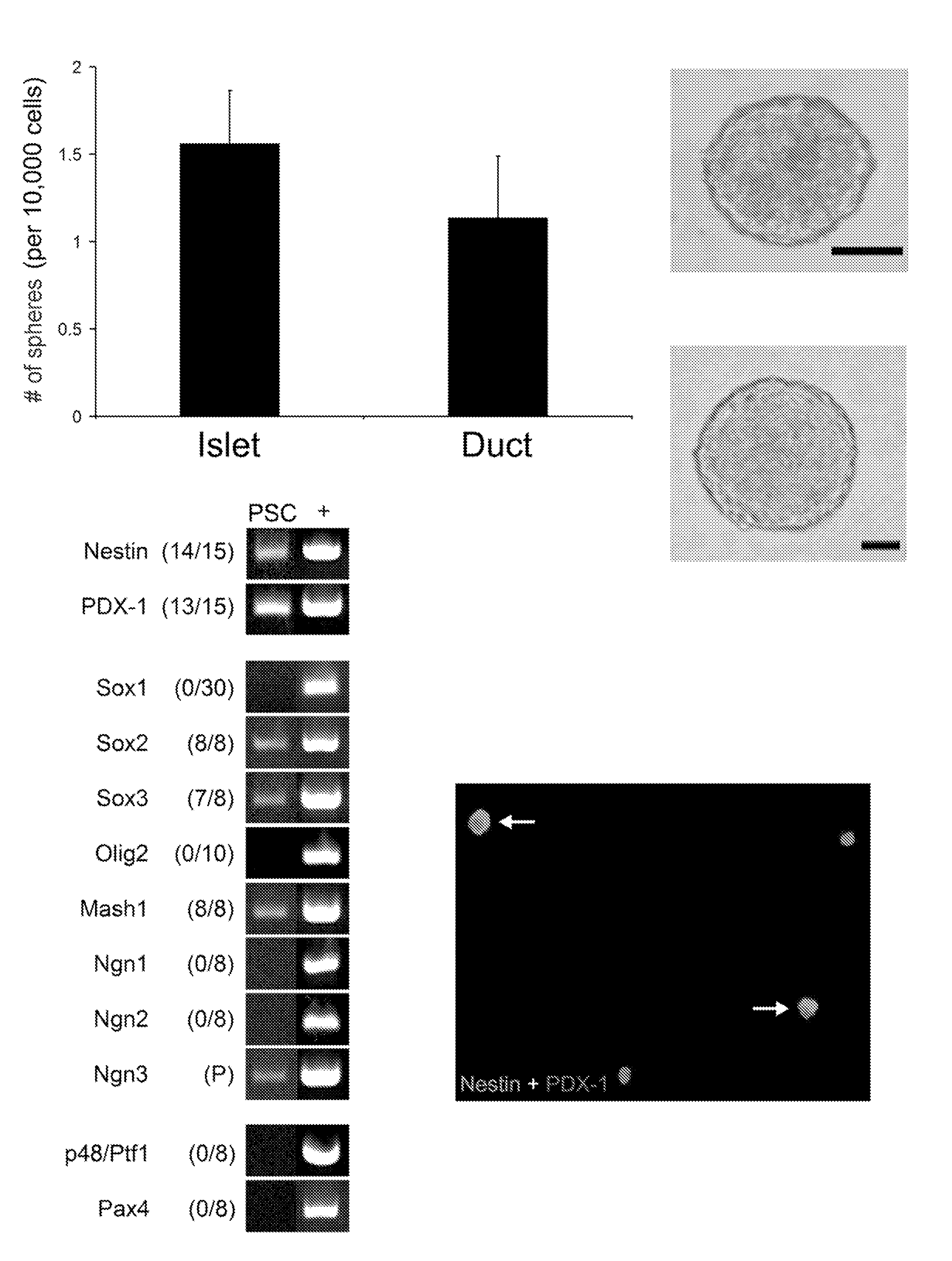 Pancreatic stem cells