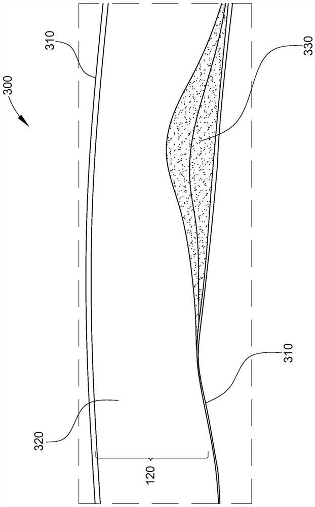 Graphical longitudinal display for intraluminal ultrasound imaging and associated devices, systems, and methods