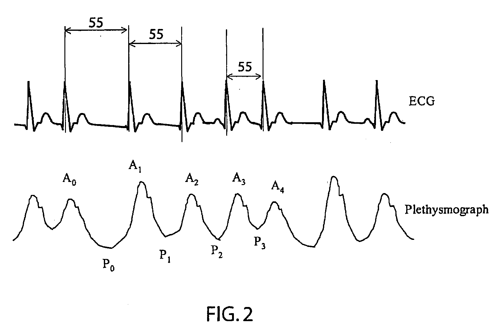 False positive reduction in spo2 atrial fibrillation detection using average heart rate and nibp