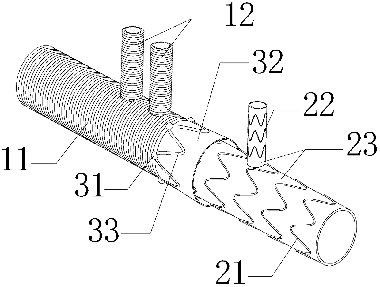 Suture-free integrated branch covered stent blood vessel