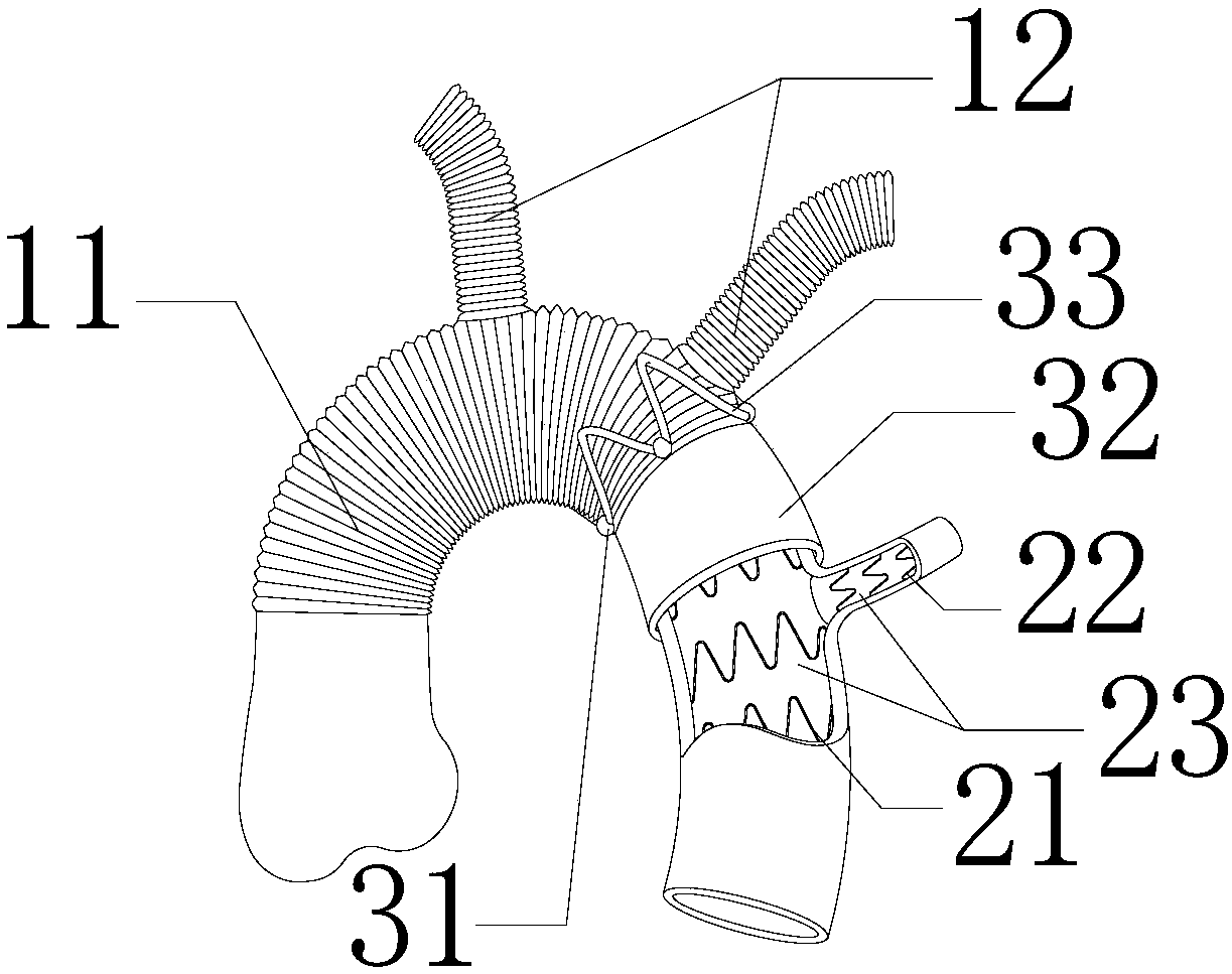 Suture-free integrated branch covered stent blood vessel