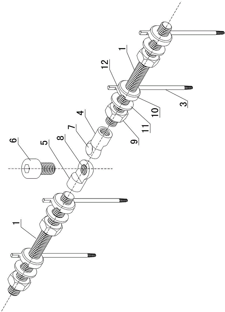 Clavicle External Fixator with Locking Joint