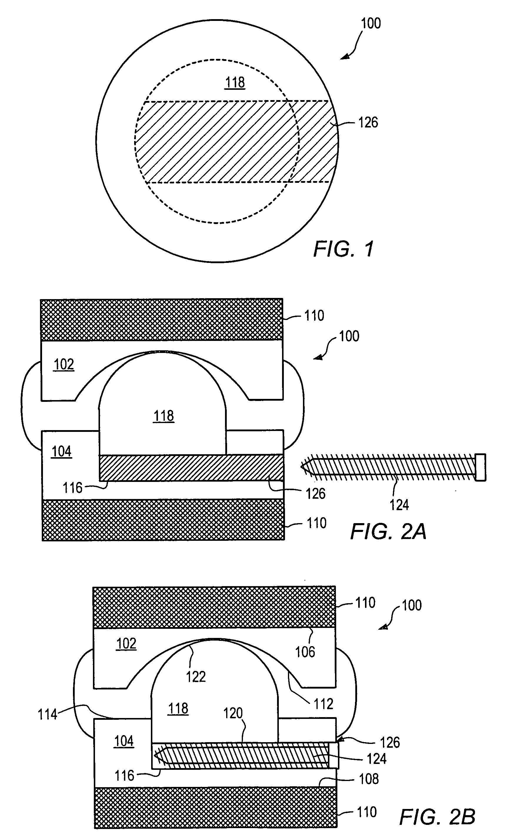 Method of inserting an expandable intervertebral implant without overdistraction