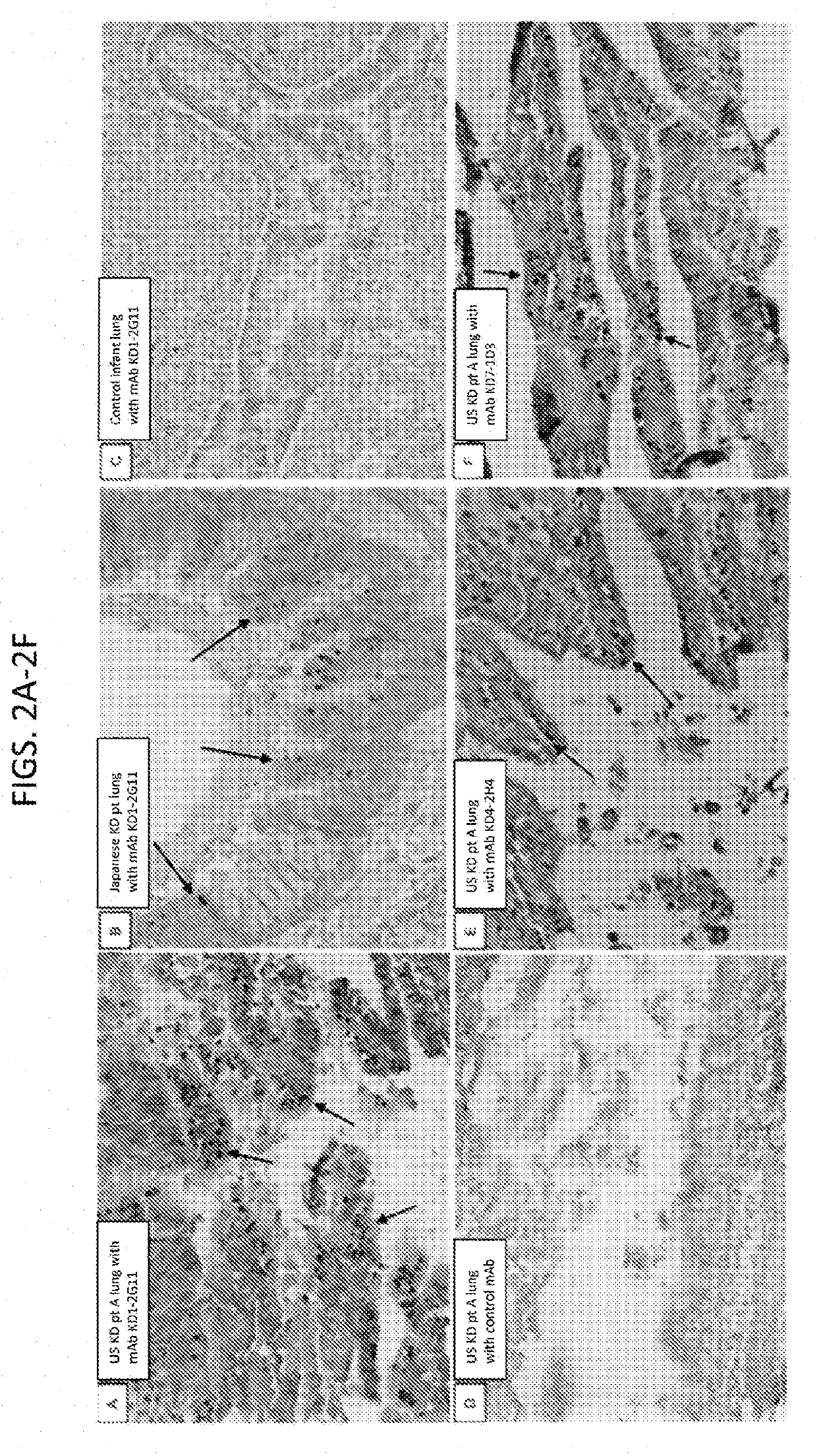 Kawasaki disease antibodies identify hepacivirus peptides