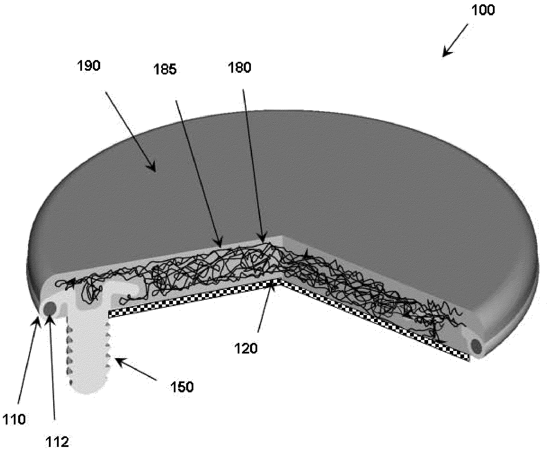 Anchoring systems and interfaces for flexible surgical implants for replacing cartilage