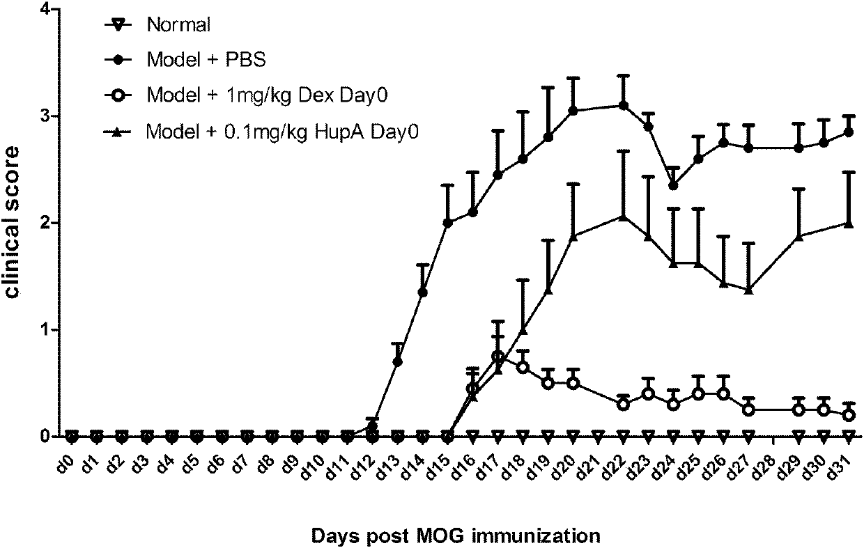 Application of Huperzine A in preparation of medicines preventing and treating multiple sclerosis disease