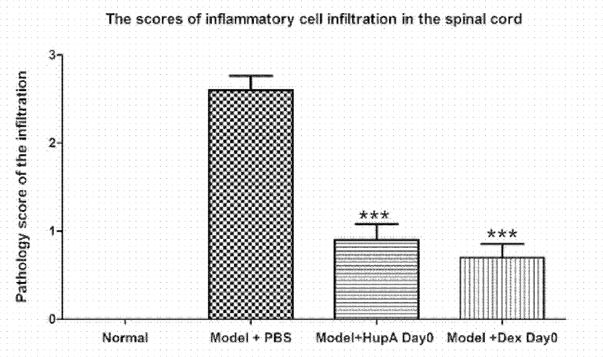 Application of Huperzine A in preparation of medicines preventing and treating multiple sclerosis disease