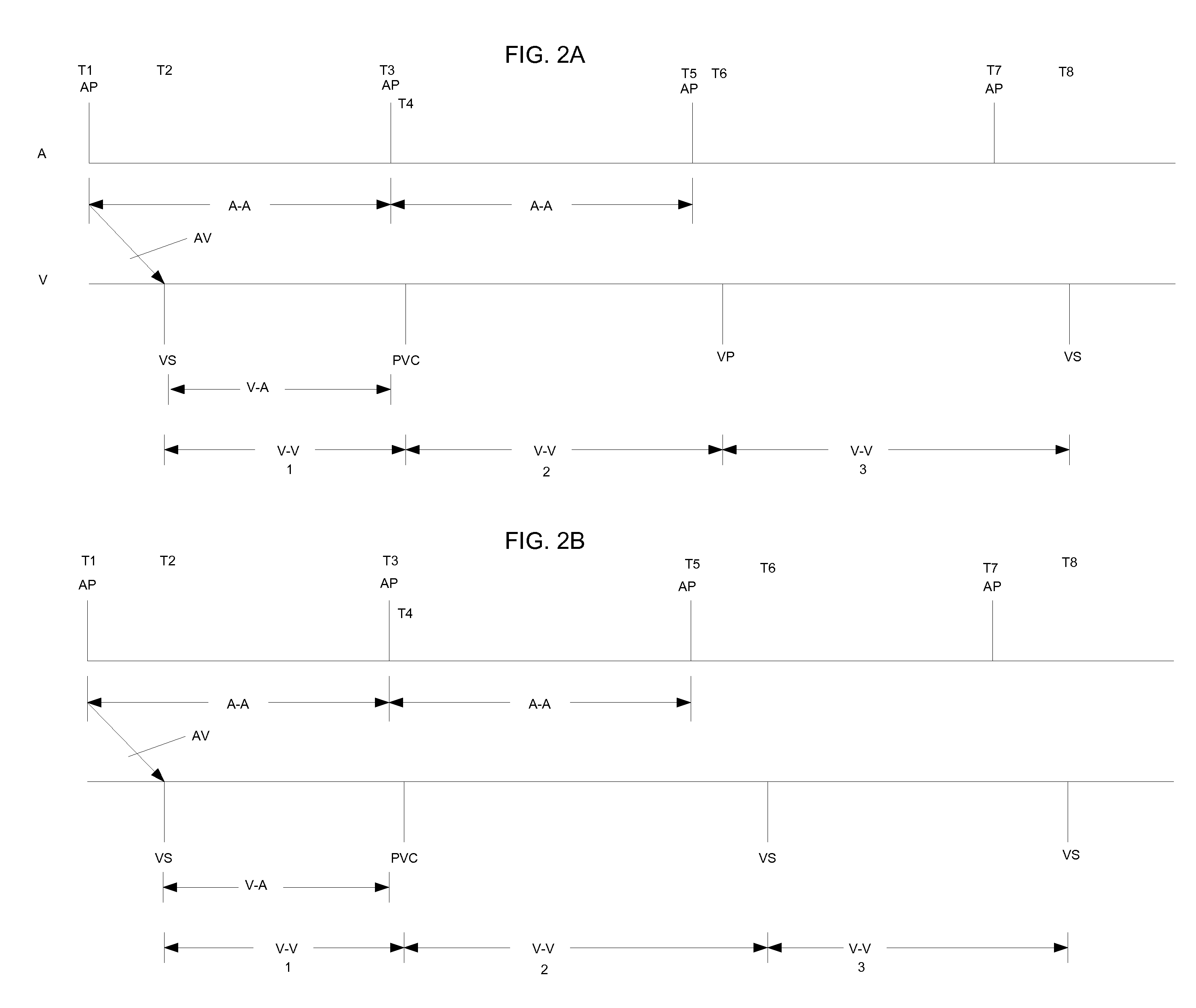 System and Method for Determining Intrinsic AV Interval Timing