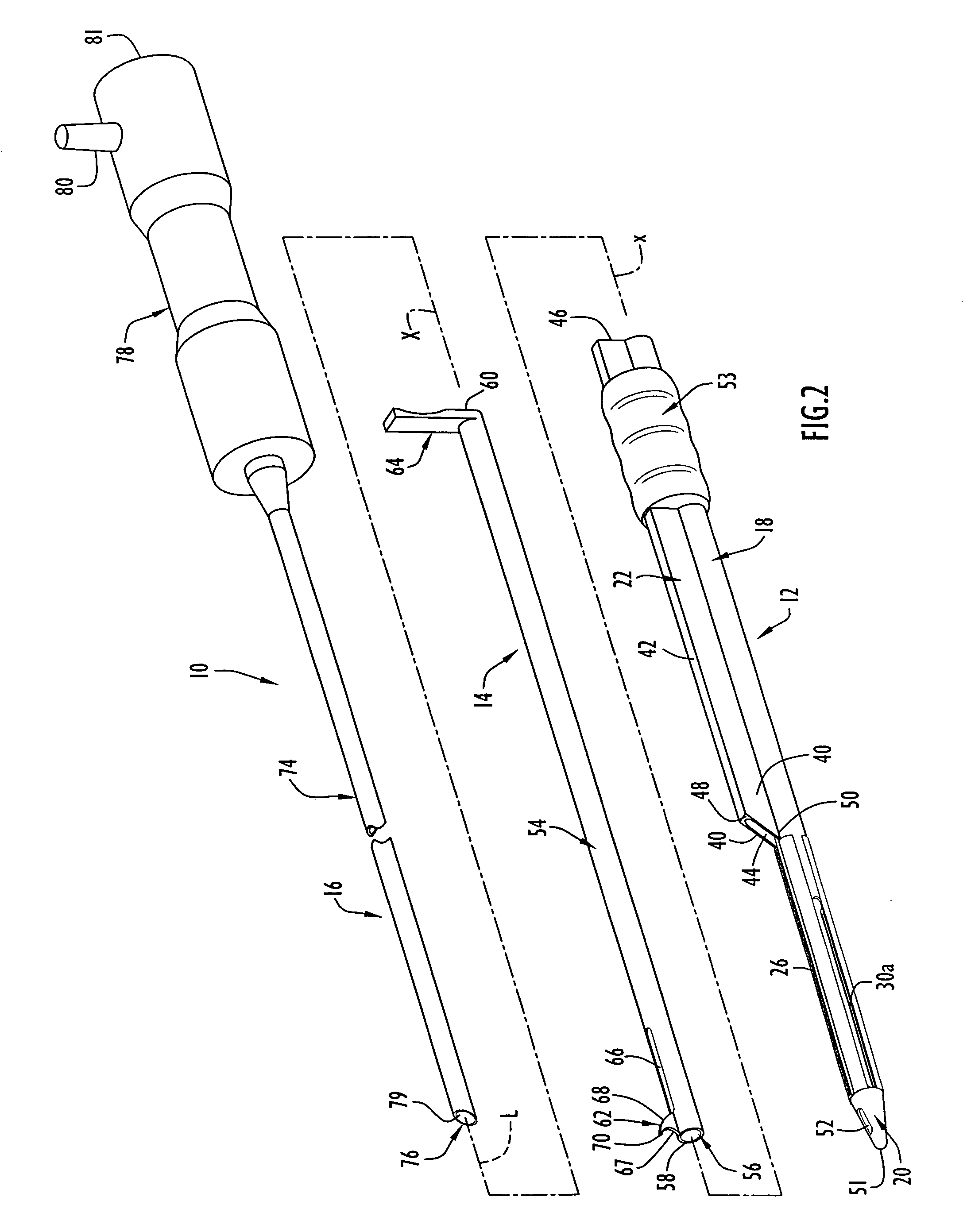 Instruments and method for minimally invasive carpal tunnel release