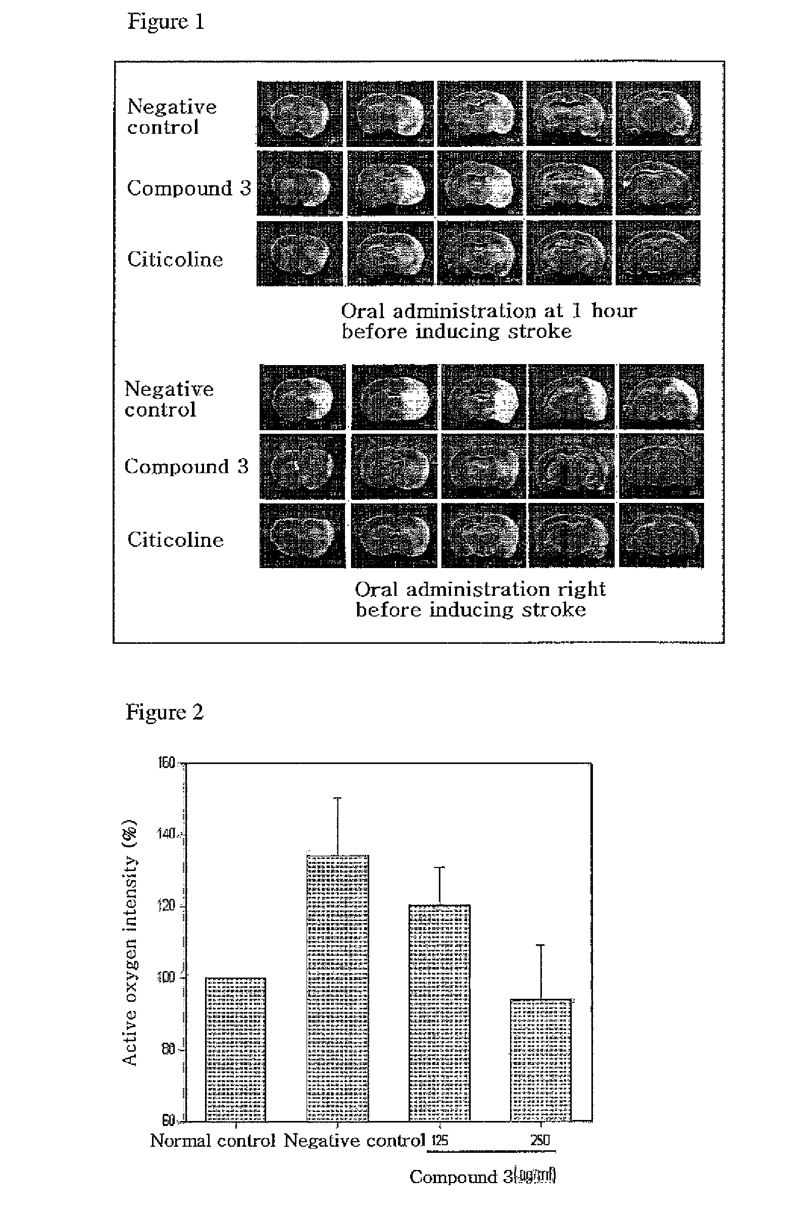 Quinazoline-2,4-dione derivative, and medical compositions for the prophylaxis and treatment of cranial nerve disease containing the same