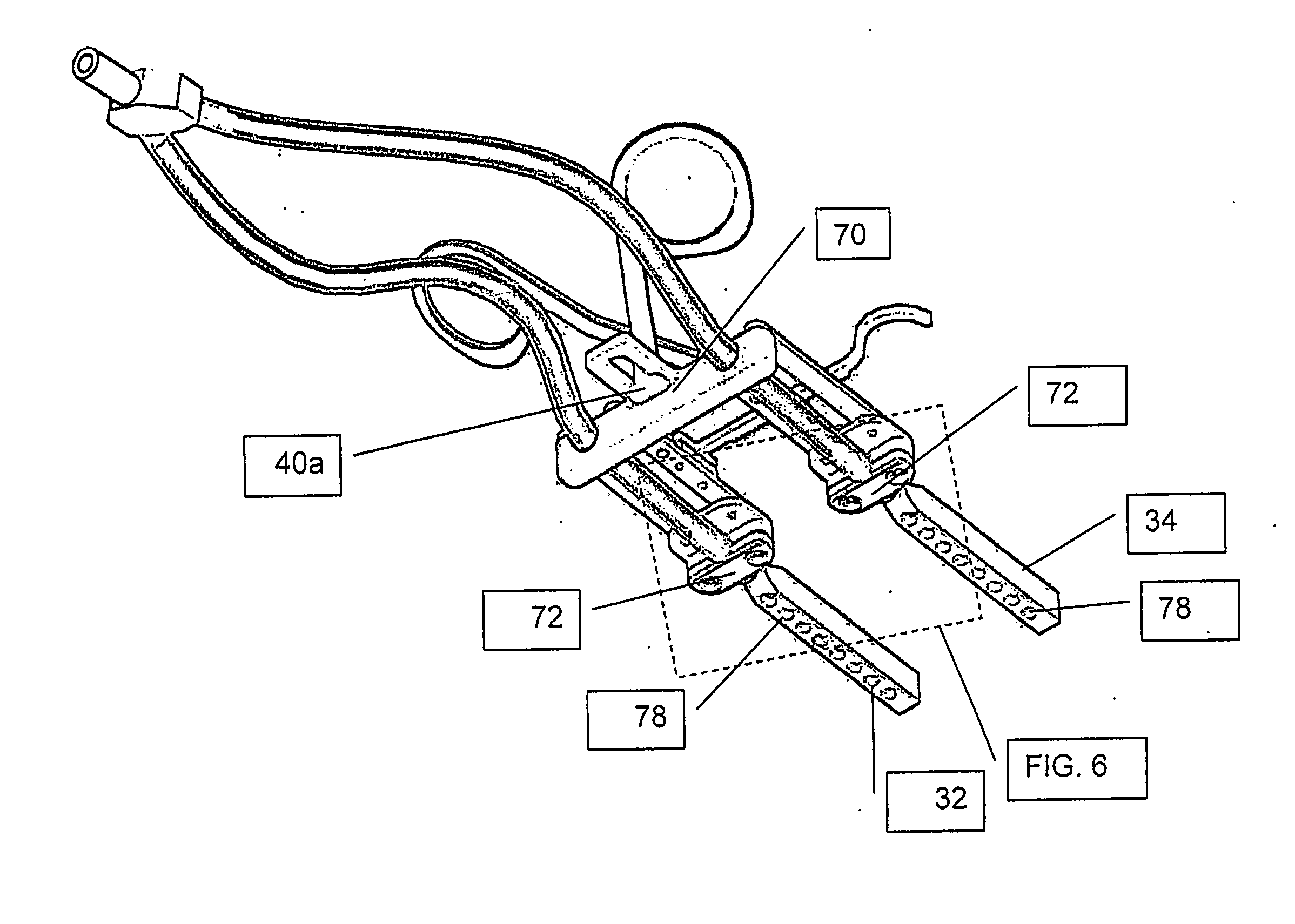 Vacuum holder for juxtaposing body tissues