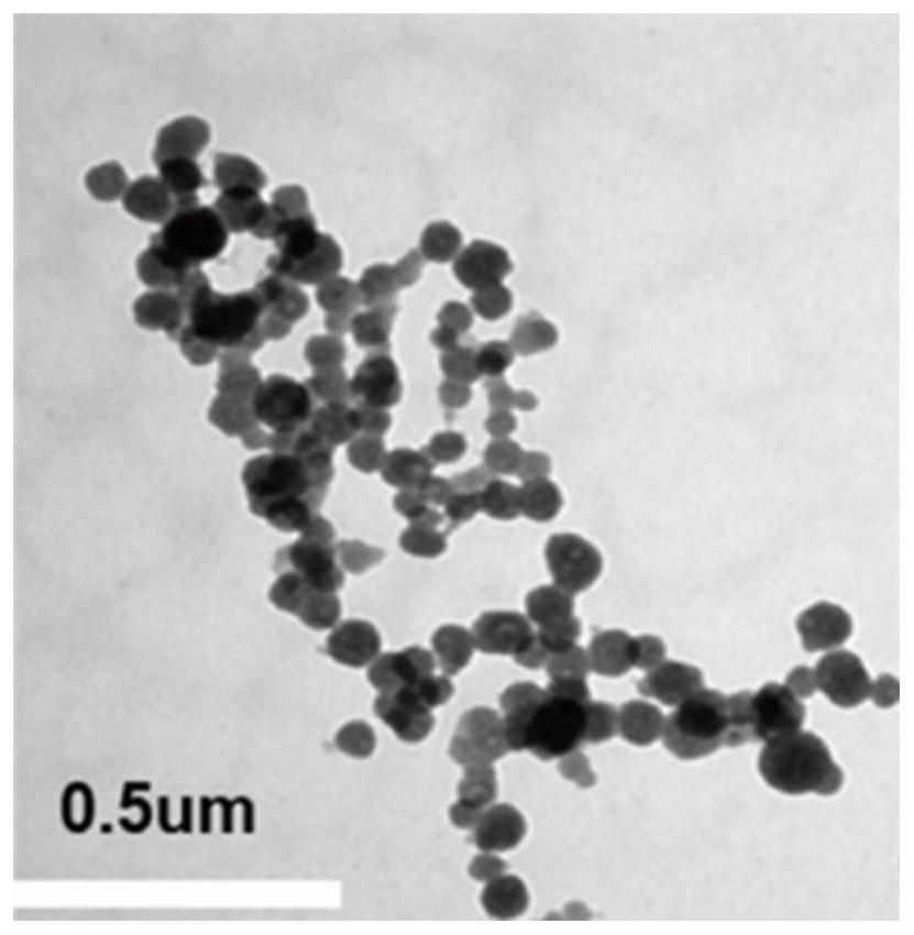 Biomineralization nano material for treating Duchenne muscular dystrophy and gene editing system