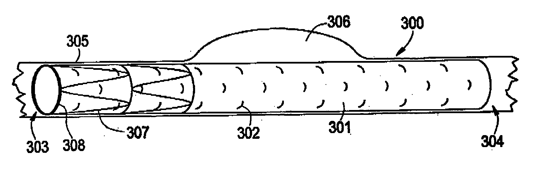 Thin film medical device and delivery system