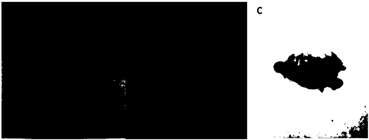 Preparation method of purpura lapillus anti-inflammatory extract, and application thereof in anti-acne medicine