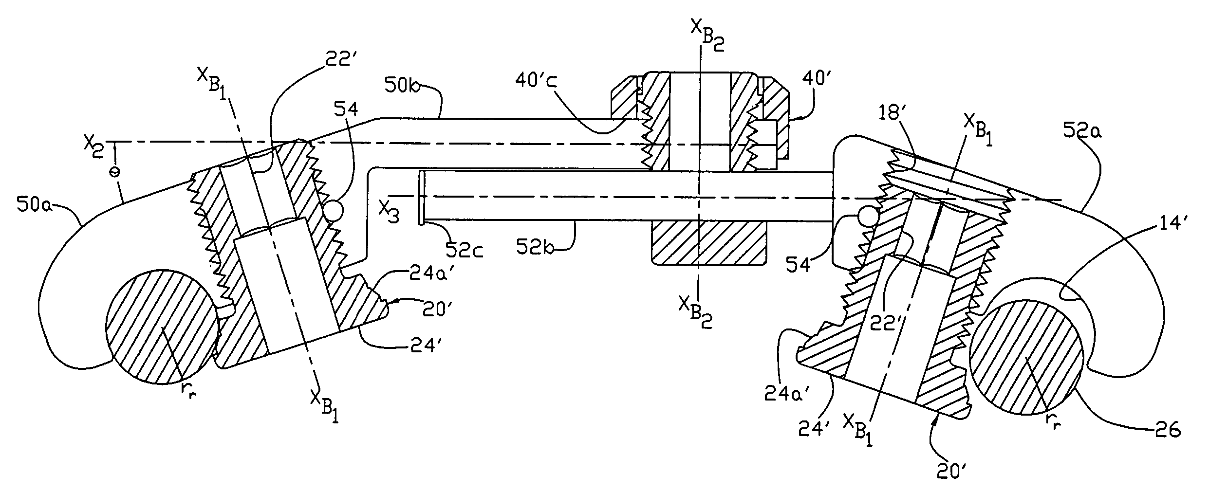 Transverse connector system