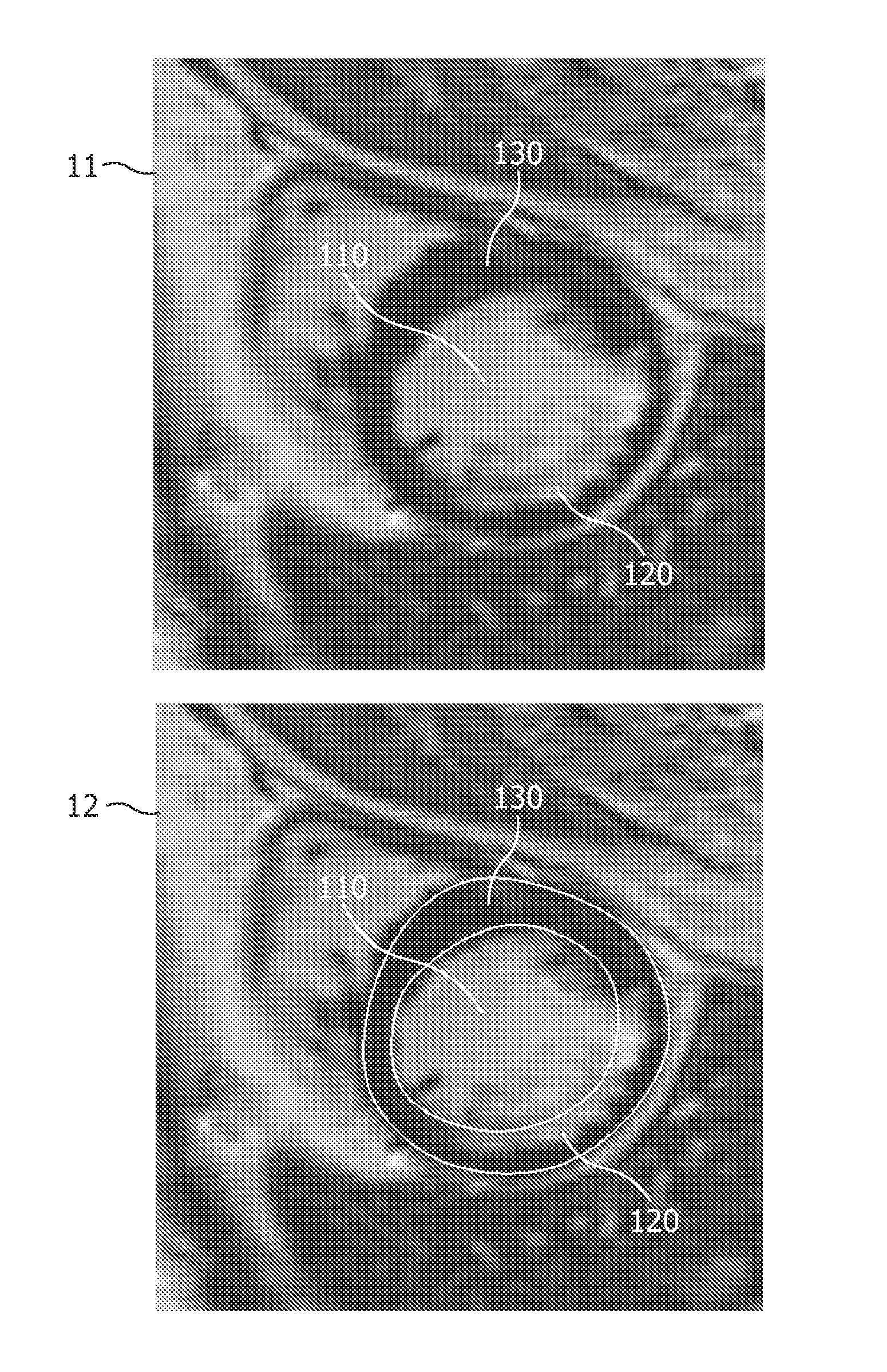 Automatic 3-D segmentation of the short-axis late-enhancement cardiac MRI