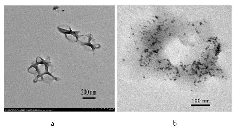 Magnetic resonance imaging contrast agent for diagnosis and treatment and preparation method thereof