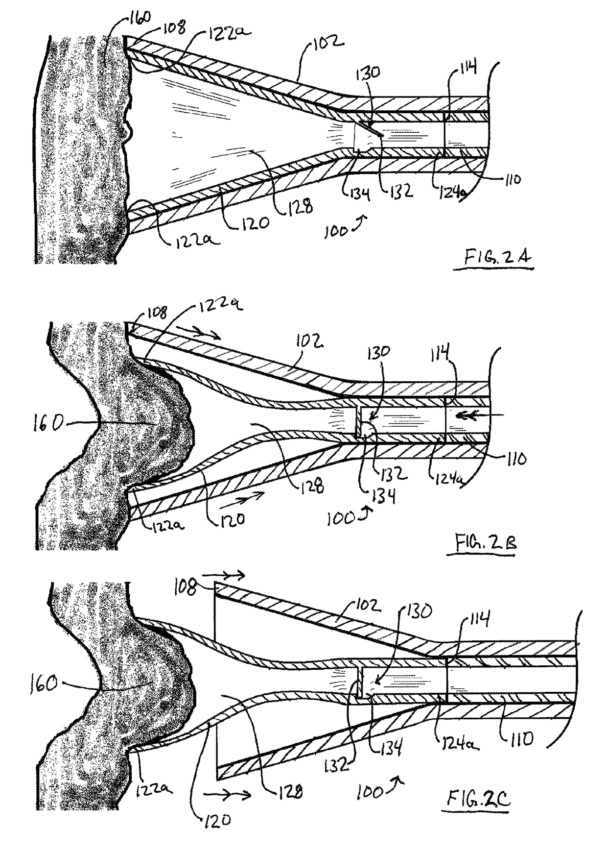 Suction clip