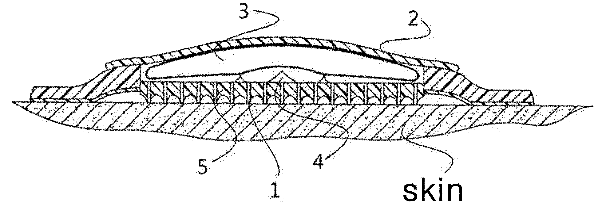 Microneedle drug delivery system including movable drug-containing capsule