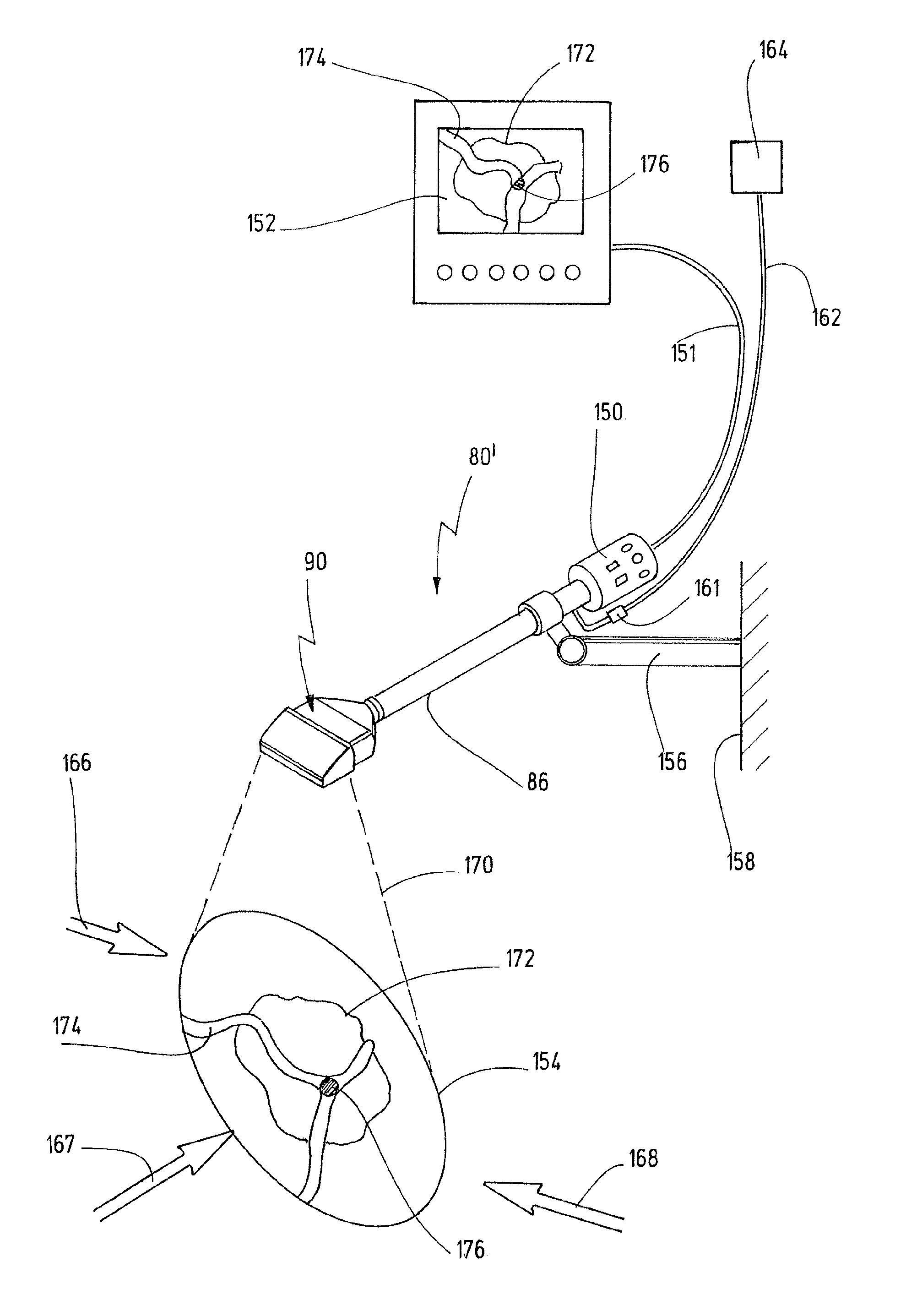 Exoscope