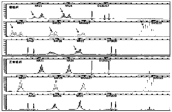 Compound amplification system and kit for MSI (microsatellite instability) gene mutation detection