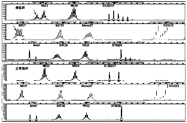 Compound amplification system and kit for MSI (microsatellite instability) gene mutation detection