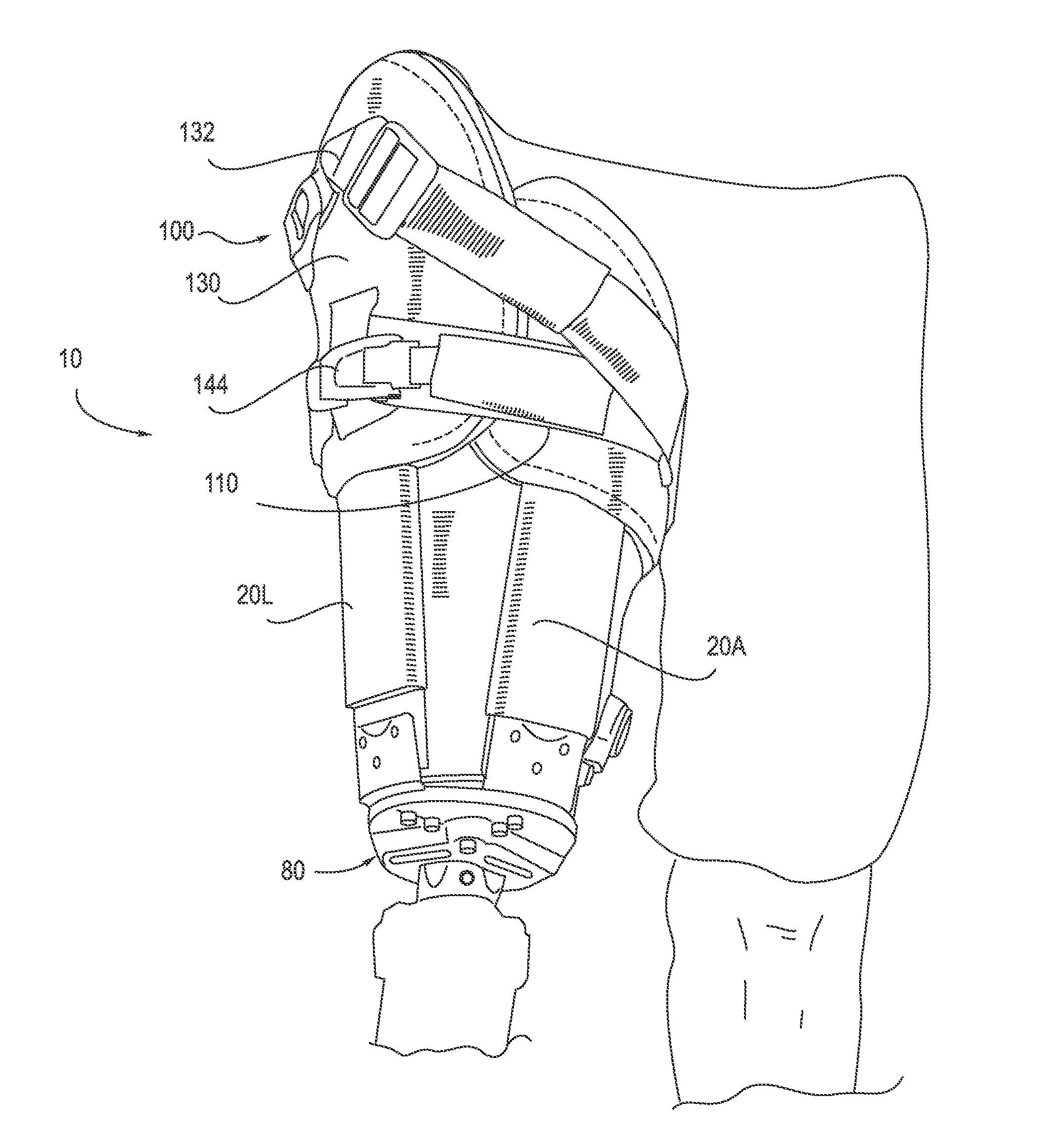 Prosthetic socket with an adjustable height ischial seat