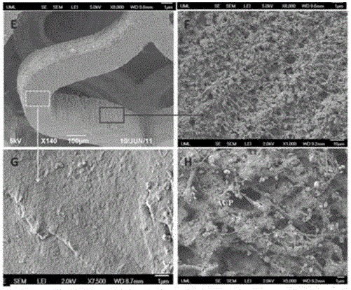 Bioabsorbable bone repair material and its use and manufacturing method