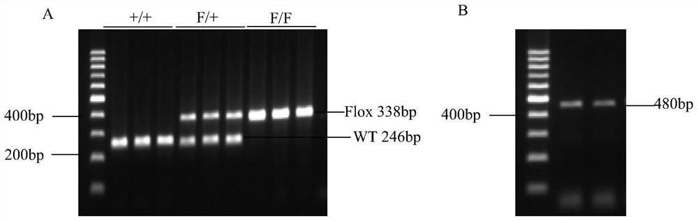 Application of RING finger protein rnf20 gene