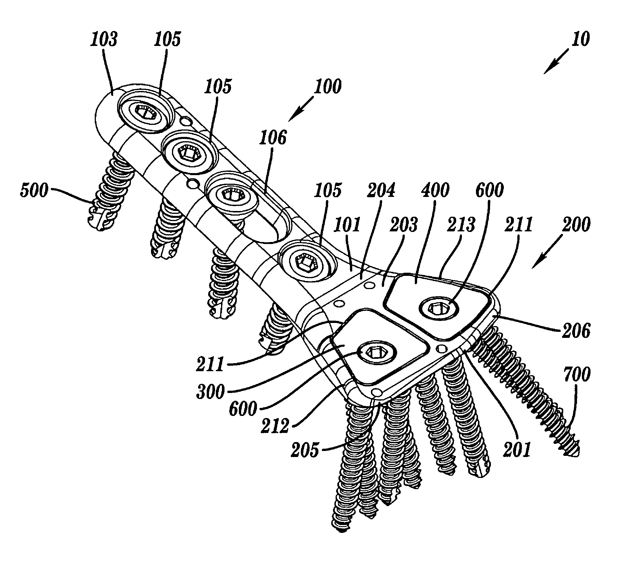 Fracture fixation plate with cover sheath