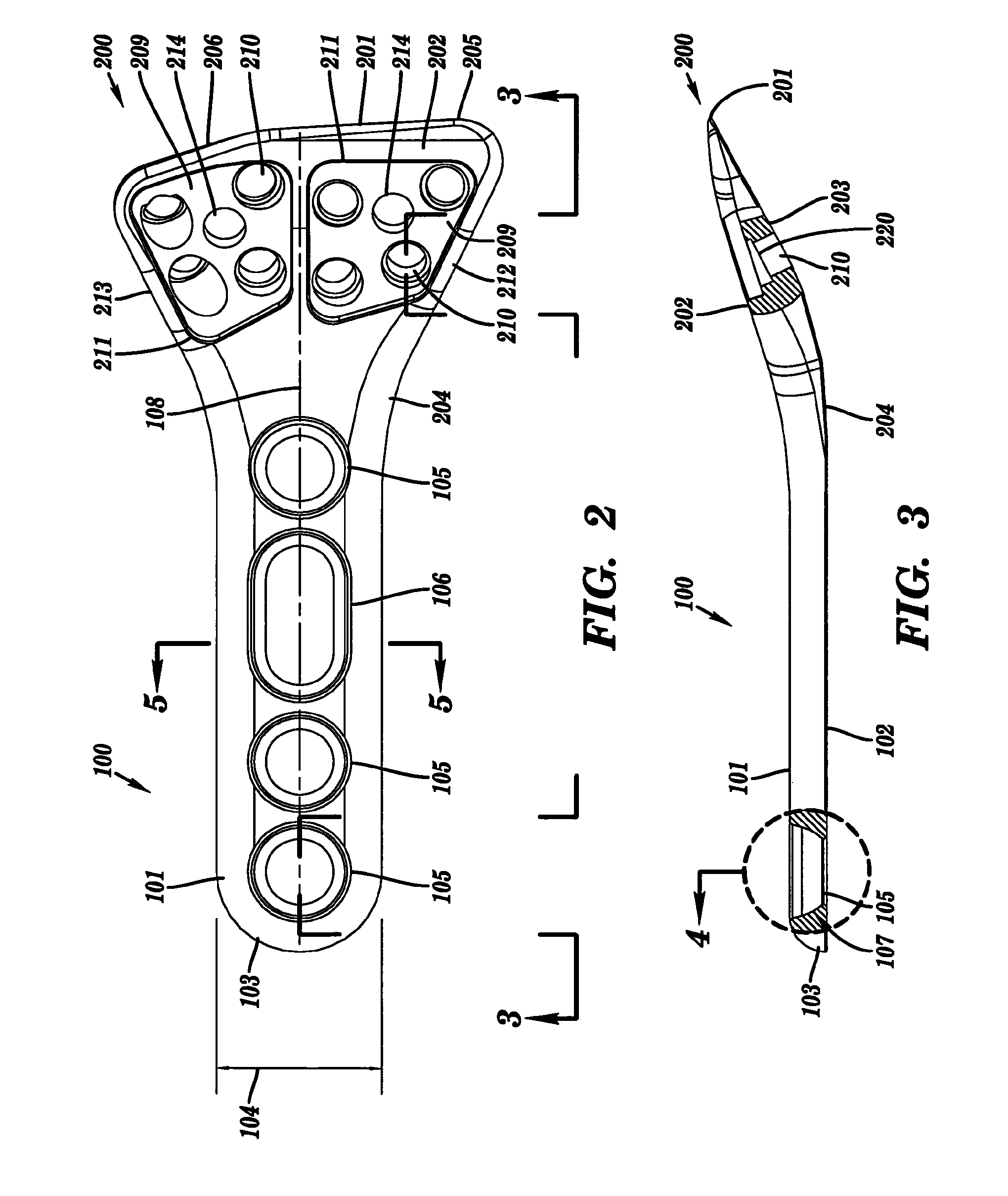 Fracture fixation plate with cover sheath