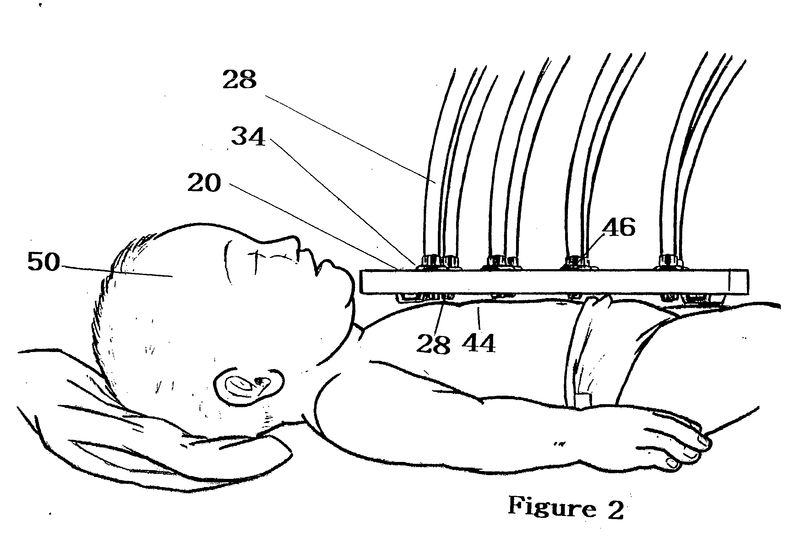 Device for treating infants with light