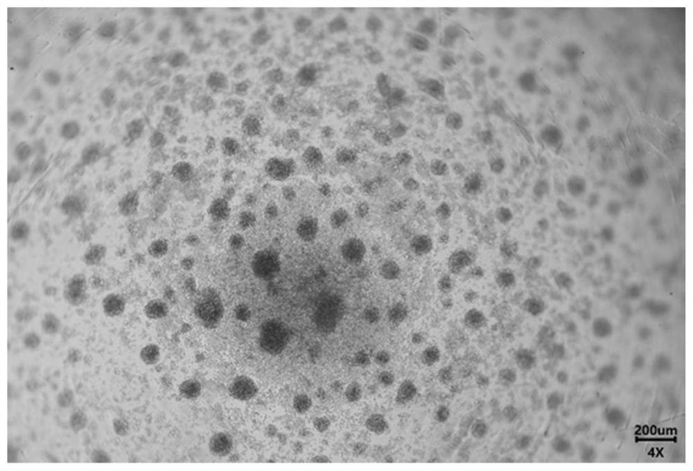 Method for cultivating and separating tumor-specific TIL cells