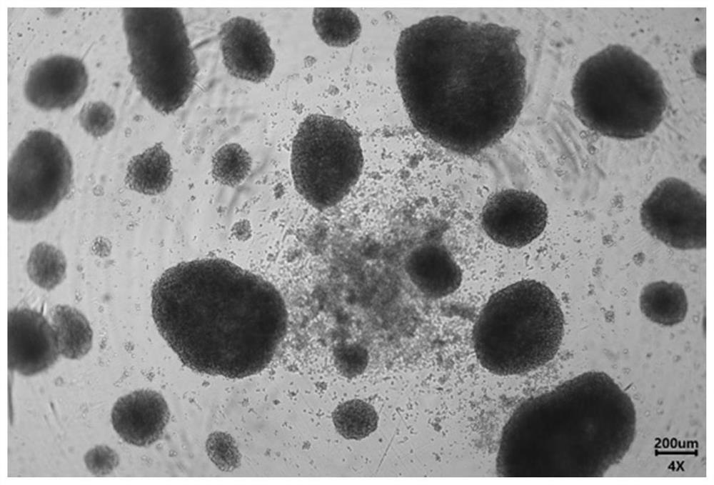 Method for cultivating and separating tumor-specific TIL cells