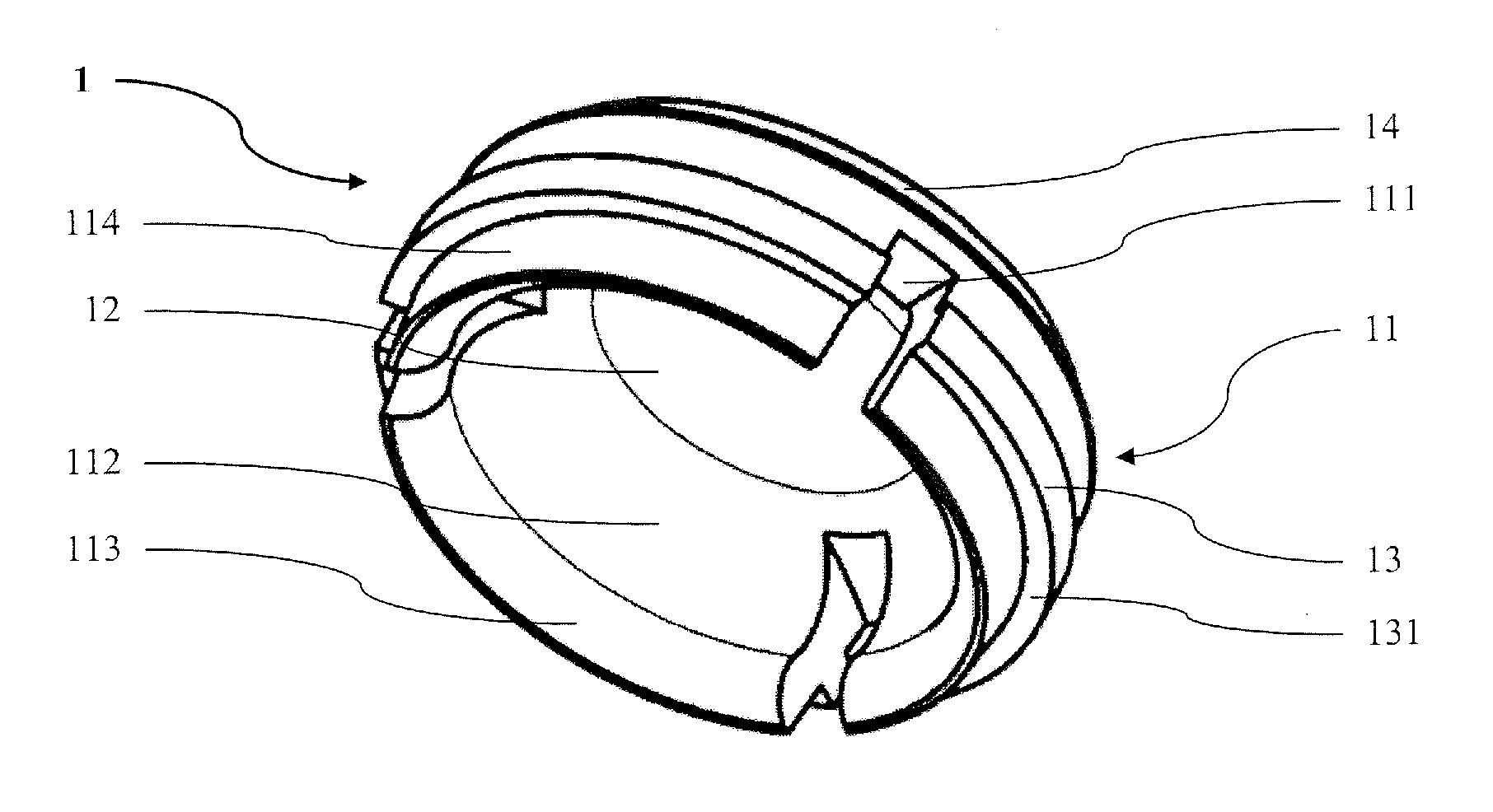 Connection of a prosthesis structure with an implant structure