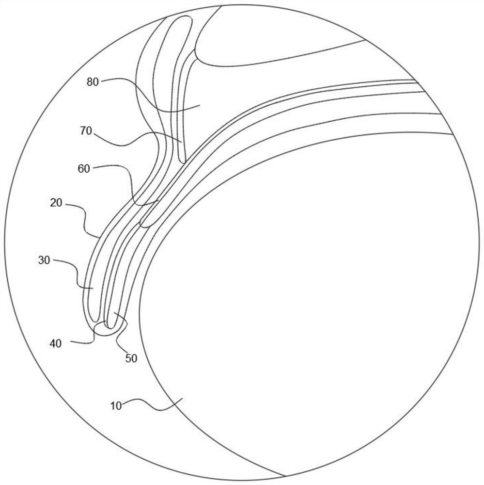 Teaching model for lifting aponeurosis tightening through double eyelid incision and operation method