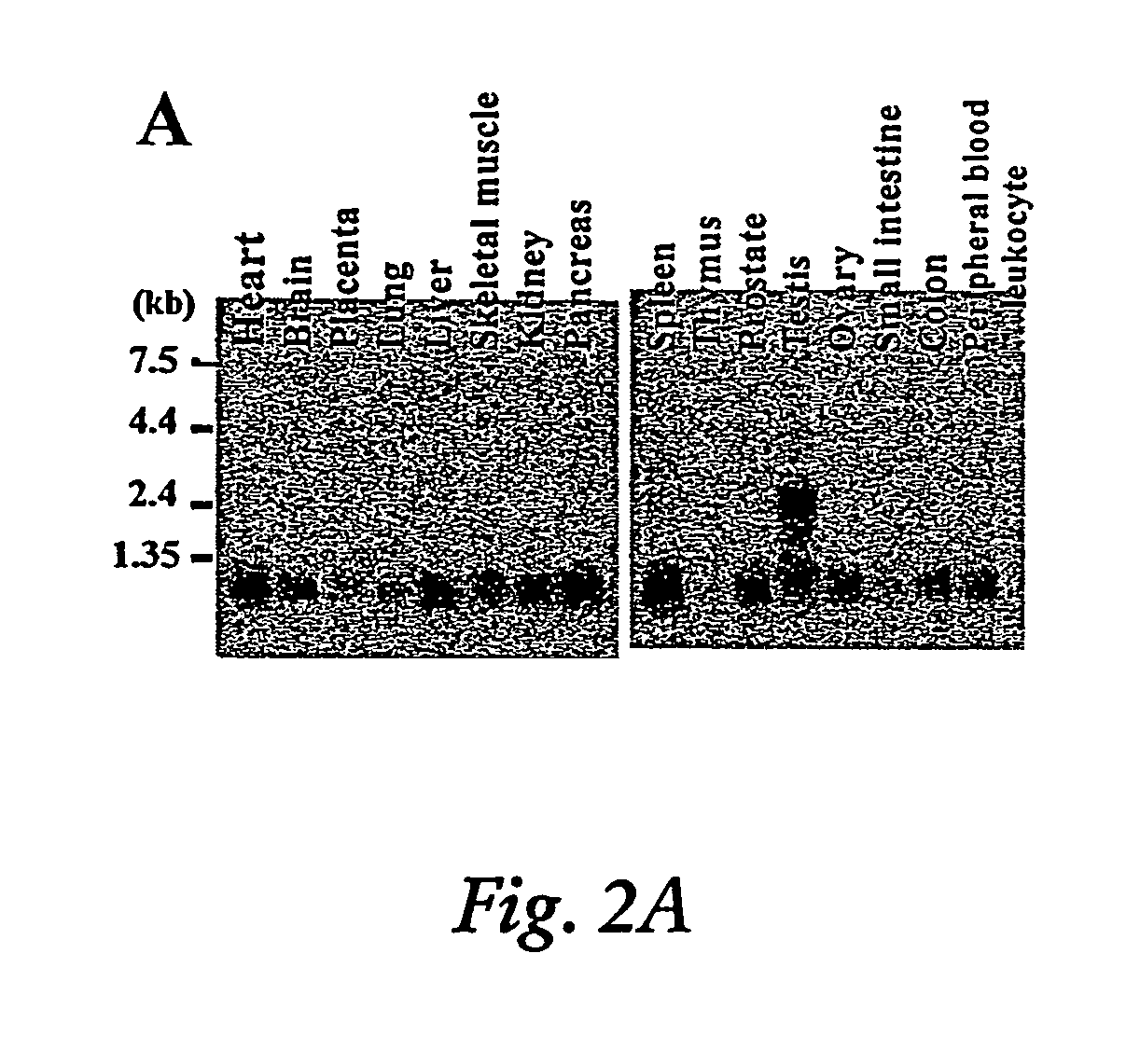 Induction of apoptosis and cell growth inhibition by protein 4.33