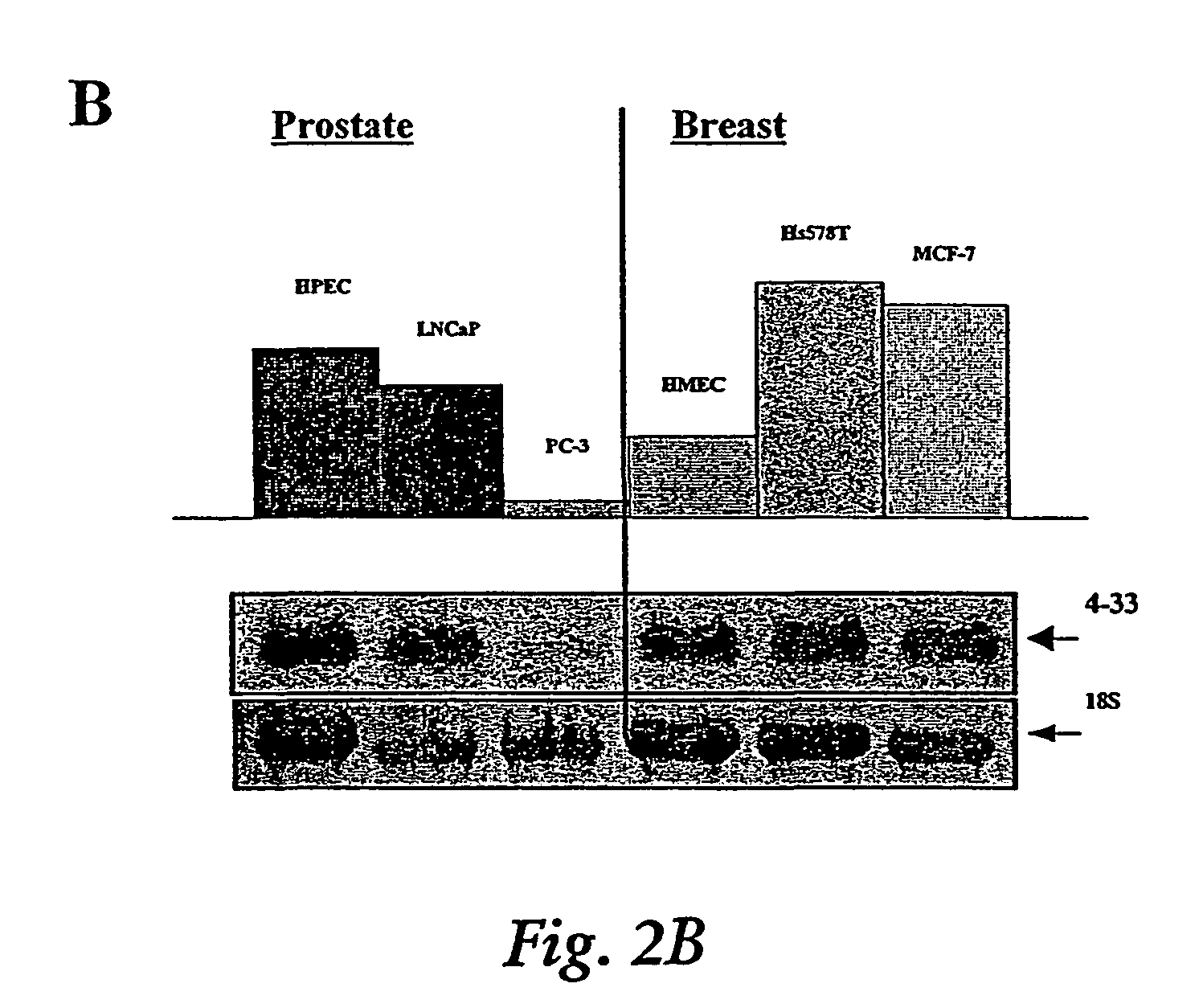 Induction of apoptosis and cell growth inhibition by protein 4.33