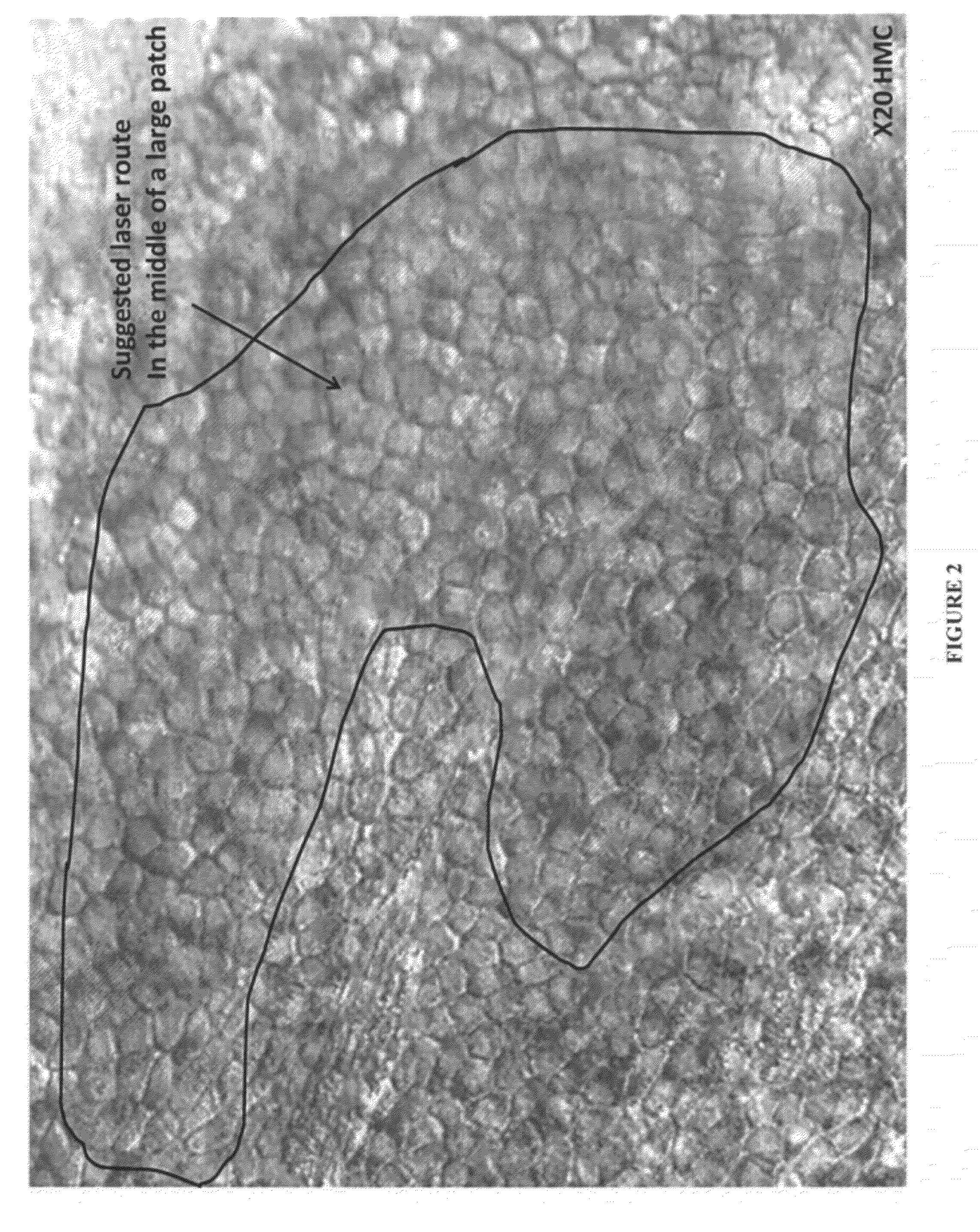 Laser isolation of viable cells