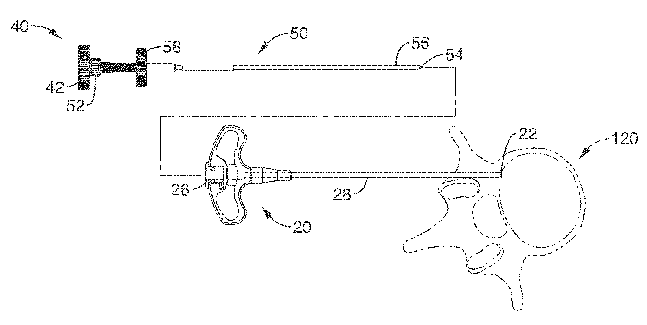 Intraosseous nerve denervation methods