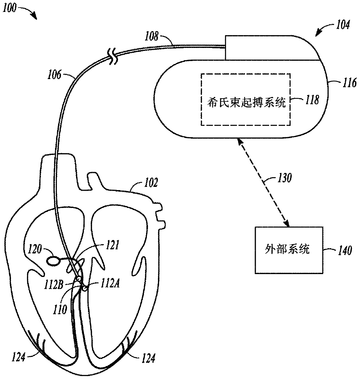 System for recognition of his-bundle pacing capture