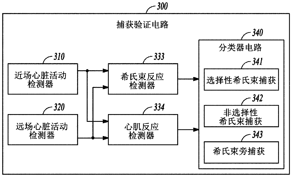 System for recognition of his-bundle pacing capture